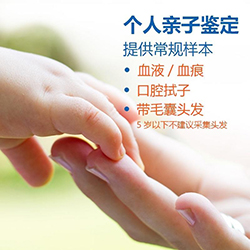南通采头发可以做亲子鉴定吗？采集头发样本的注意事项？