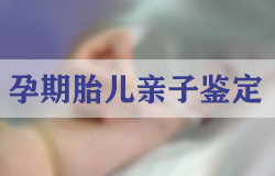 南通采头发样本能做亲子鉴定吗,采集头发样本需要注意什么